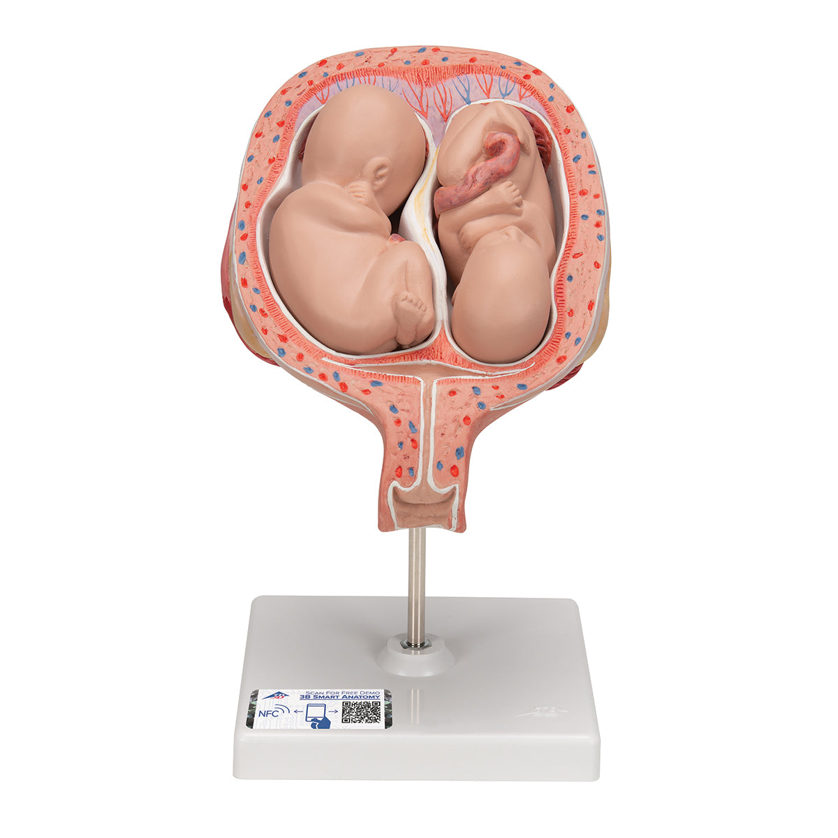 Twin Fetuses Model, 5th Month in Normal Position