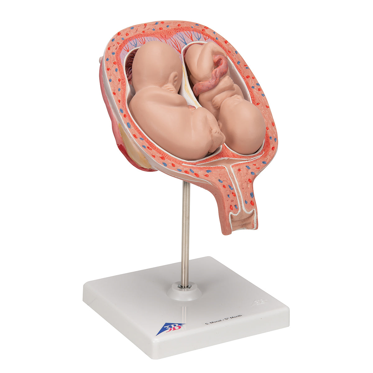 Twin Fetuses Model, 5th Month in Normal Position