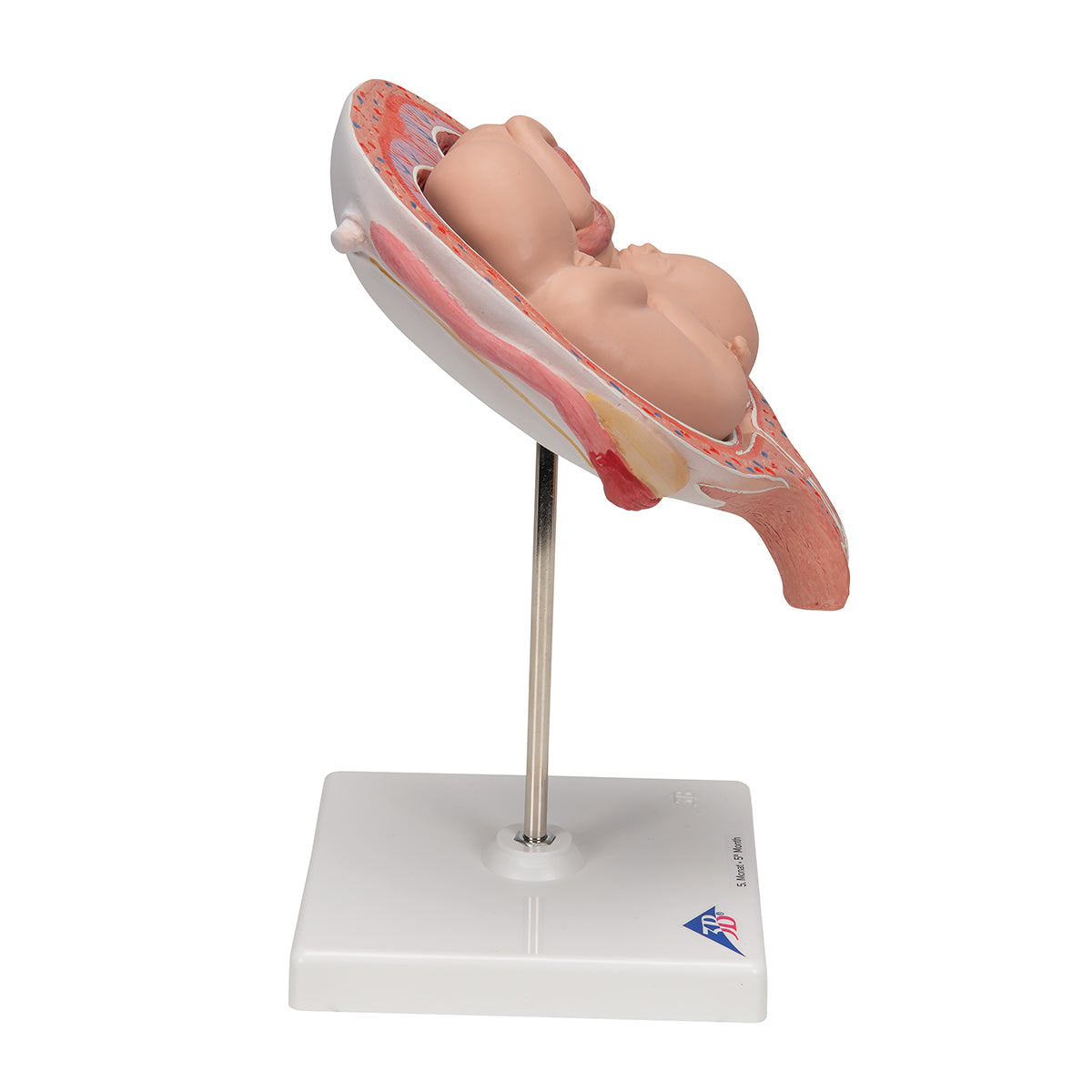 Twin Fetuses Model, 5th Month in Normal Position