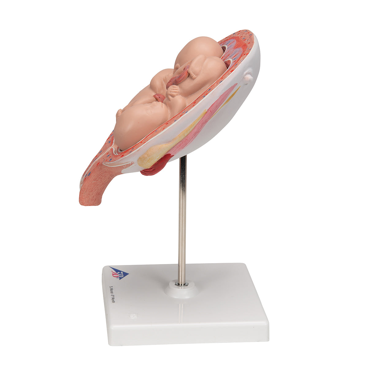 Twin Fetuses Model, 5th Month in Normal Position