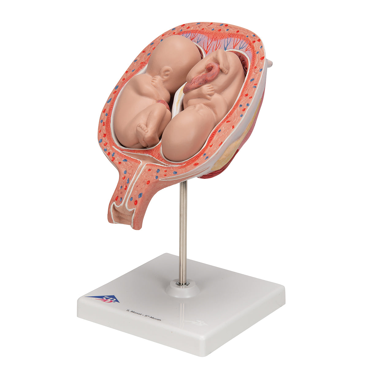 Twin Fetuses Model, 5th Month in Normal Position