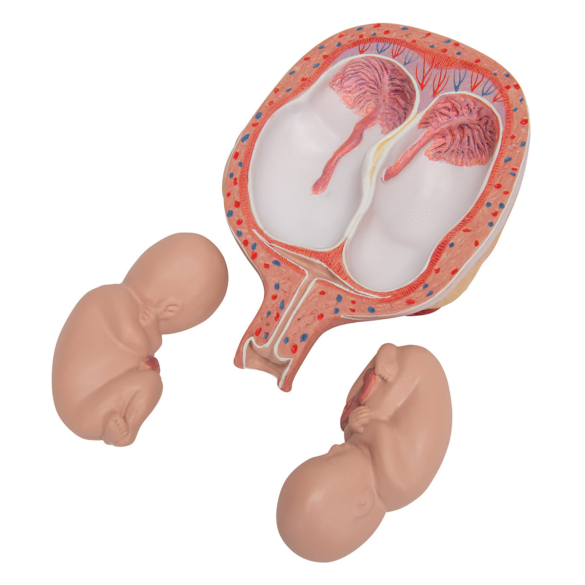 Twin Fetuses Model, 5th Month in Normal Position