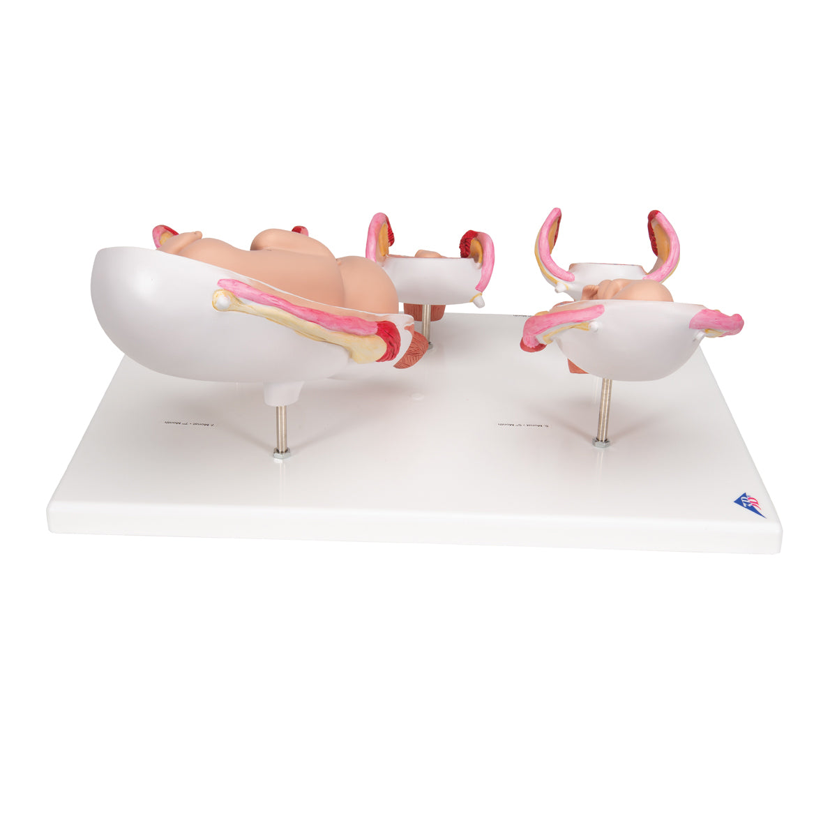 Pregnancy Models Series, 5 Embryo & Fetus Models on a Base