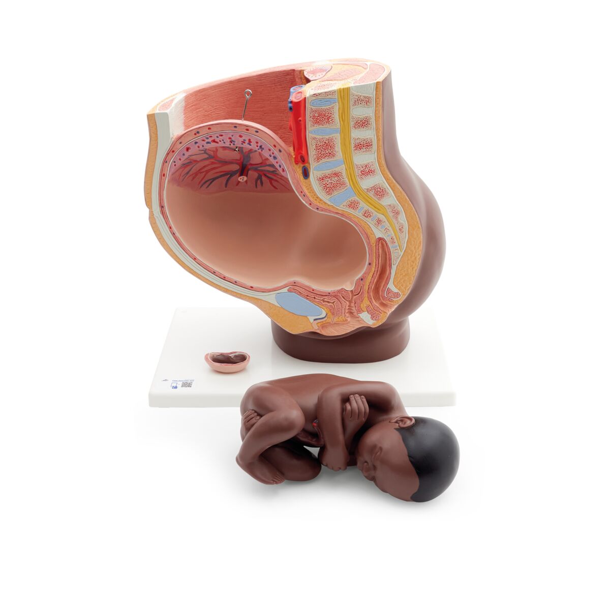 Pregnancy Pelvis Model in Median Section with Removable Fetus (40 weeks), 3 part, dark skin
