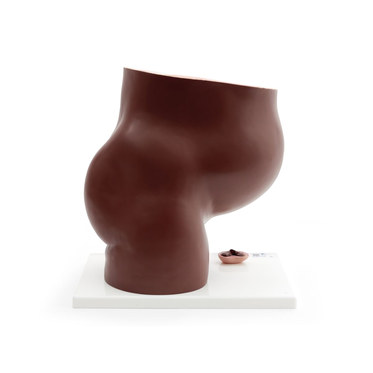 Pregnancy Pelvis Model in Median Section with Removable Fetus (40 weeks), 3 part, dark skin