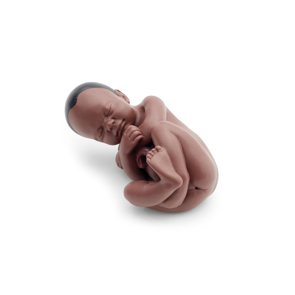 Pregnancy Pelvis Model in Median Section with Removable Fetus (40 weeks), 3 part, dark skin