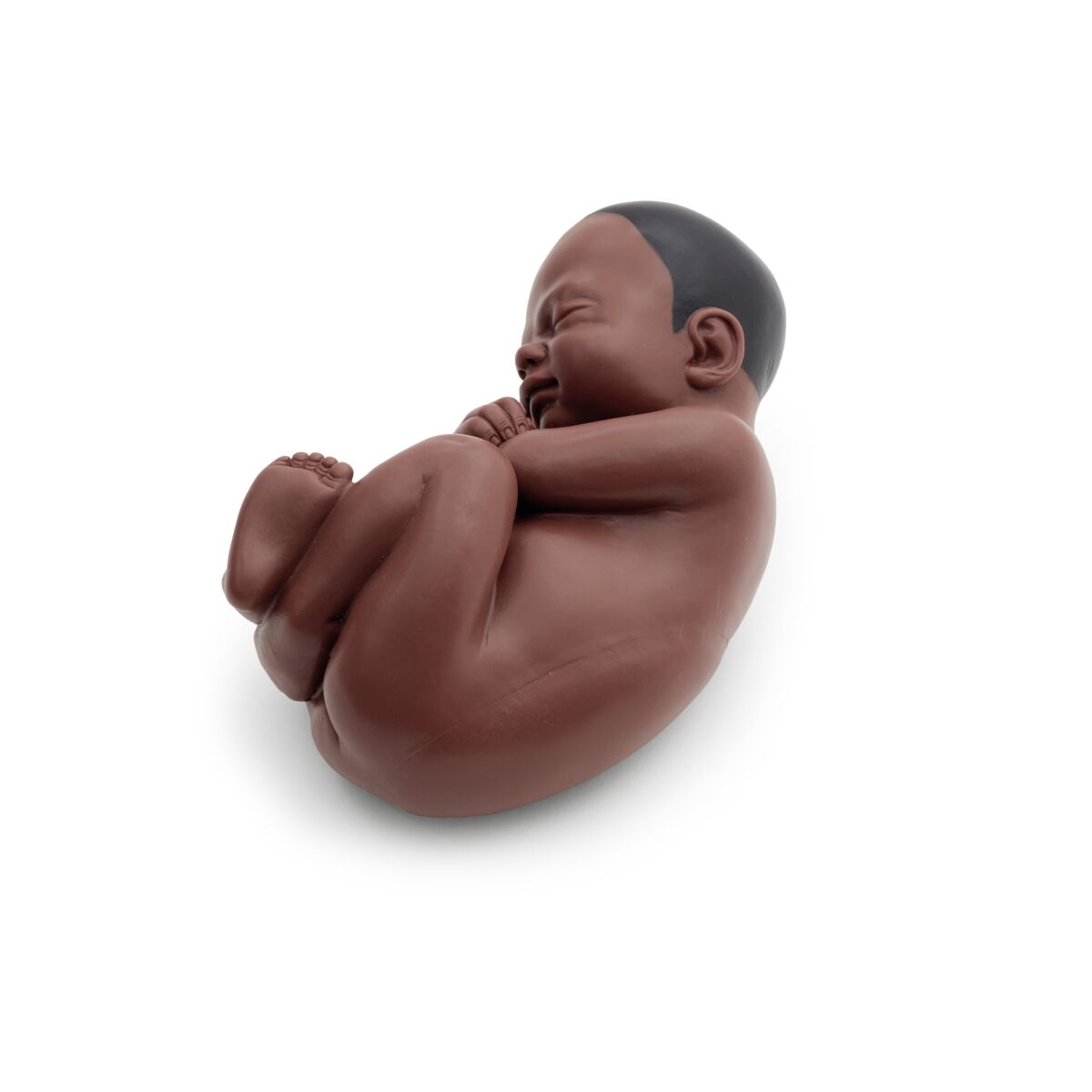 Pregnancy Pelvis Model in Median Section with Removable Fetus (40 weeks), 3 part, dark skin