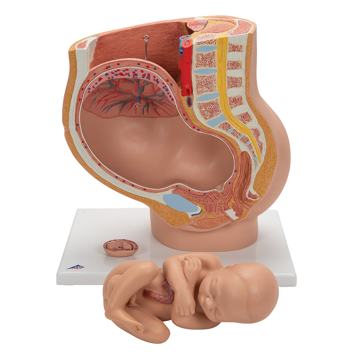 Pregnancy Pelvis Model in Median Section with Removable Fetus (40 weeks), 3 part