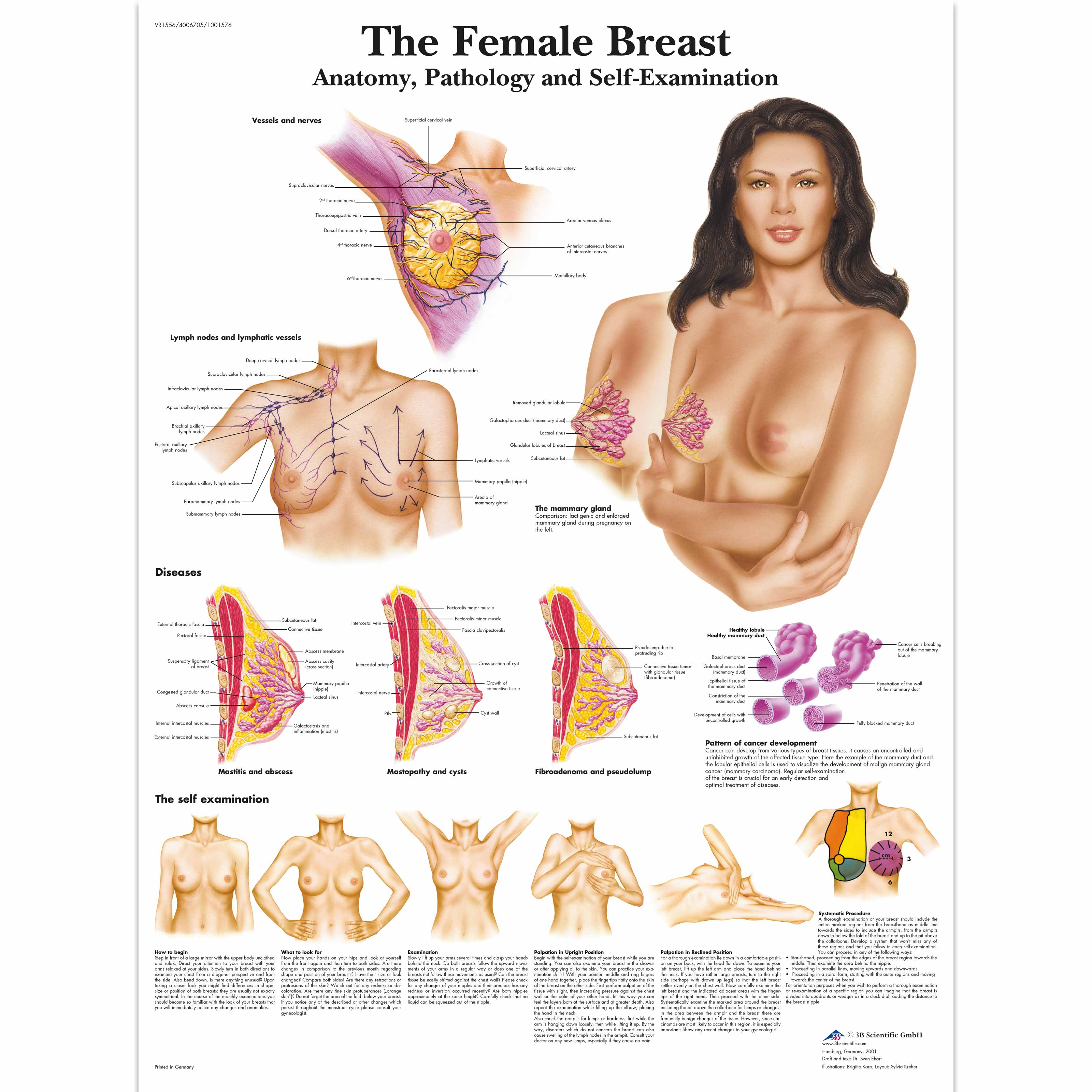 Wearable Breast Self Examination Model W/Case, Dark Skin