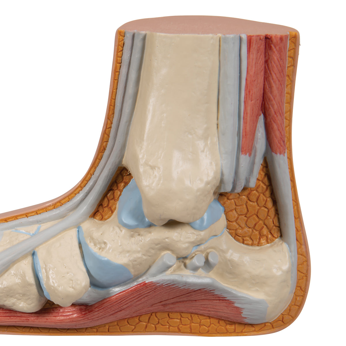 Flat Foot (Pes Planus) Model - 3B Scientific M31, view 7