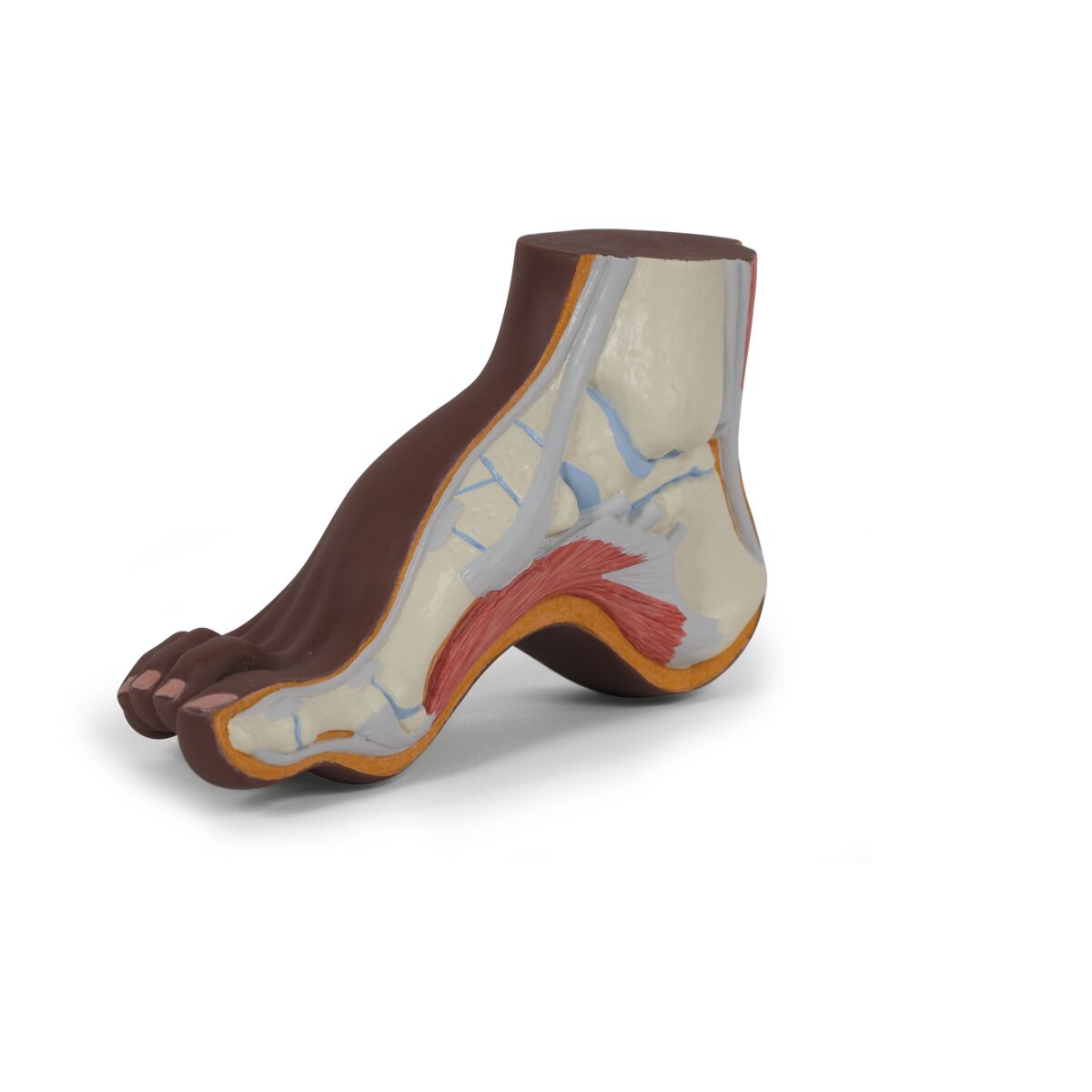 M32d Hollow Foot Pes Cavus Model - Dark Skin M32D — 3B Scientific