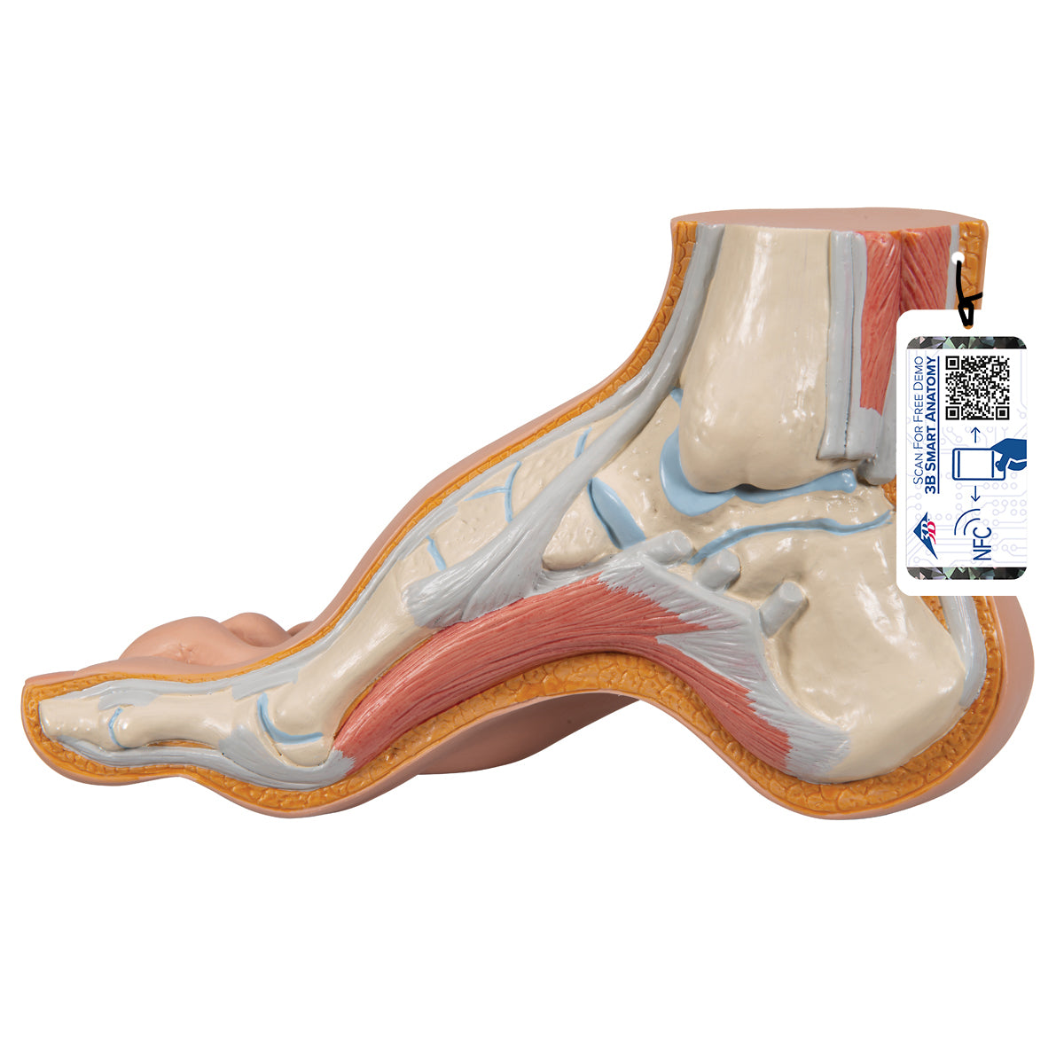 Hollow Foot (Pes Cavus) Model - 3B Scientific M32, view 8