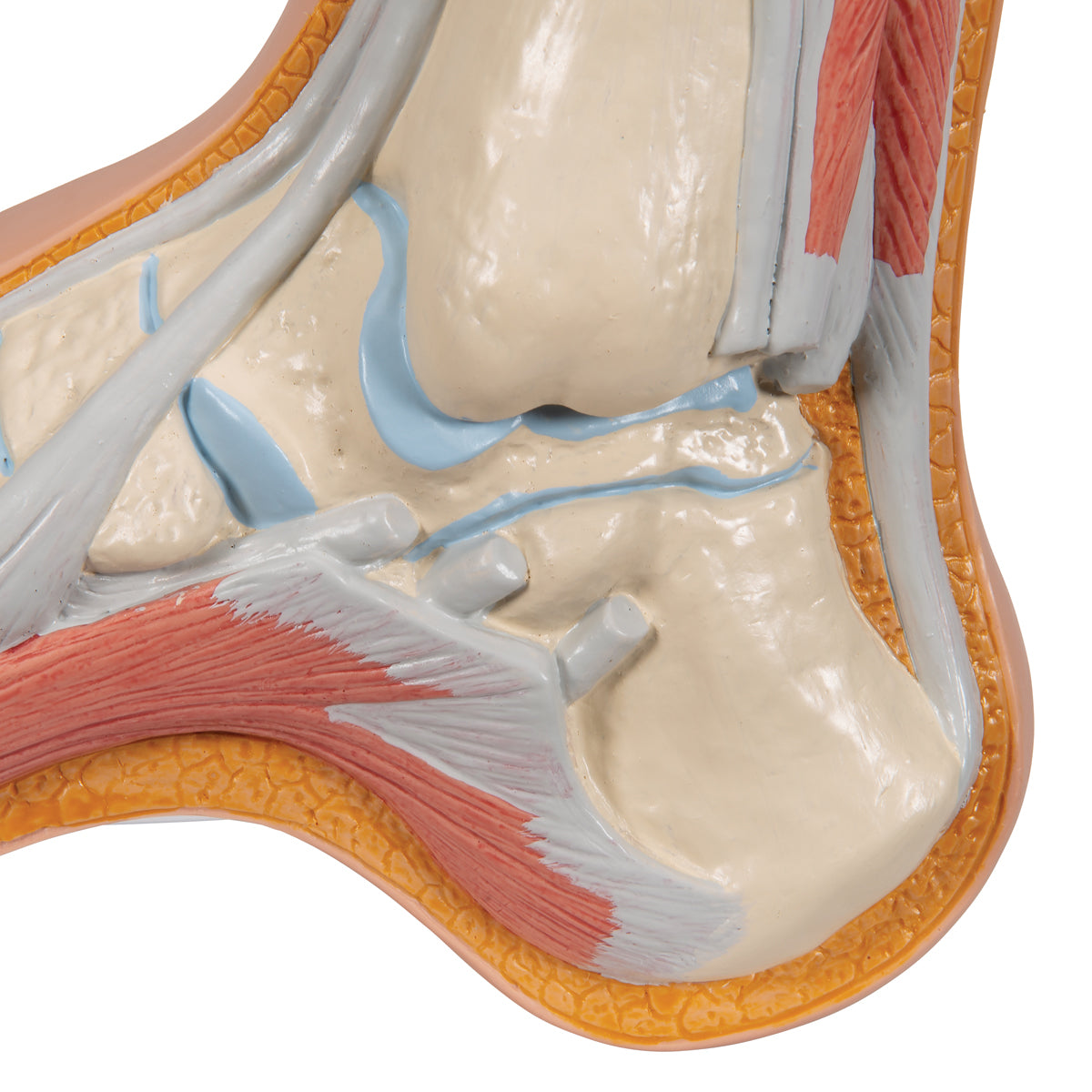 Hollow Foot (Pes Cavus) Model - 3B Scientific M32, view 14