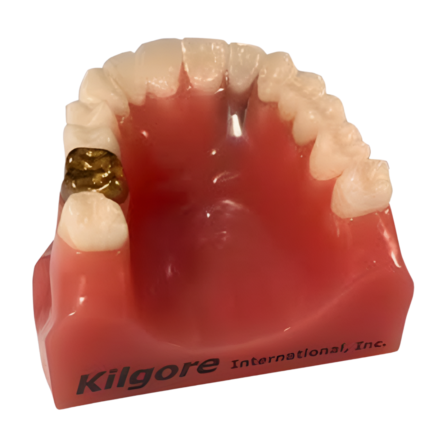 MKI.349 – Cosmetic Crown and Bridge Model