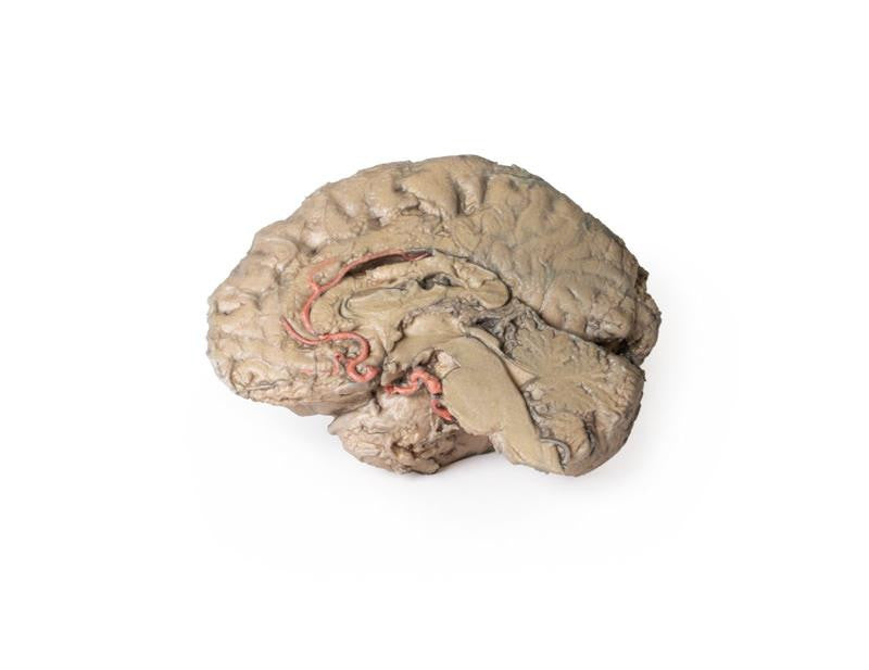 Brain Hemisection 3D Replica MP1102 | Erler-Zimmer | Candent 3
