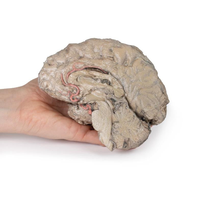 Brain Hemisection 3D Replica MP1102 | Erler-Zimmer | Candent 4
