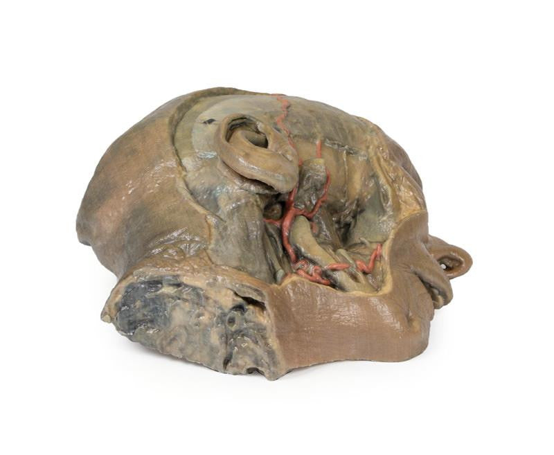 Sagittal Section of head with infratemporal Fossa Dissection 3D Replica MP1104 | Erler-Zimmer | Candent 2