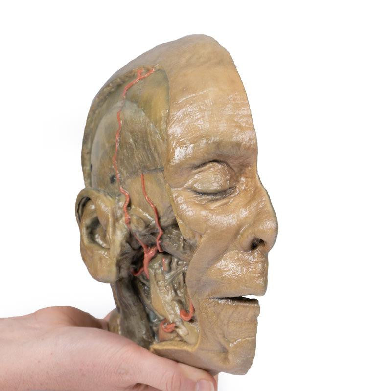Sagittal Section of head with infratemporal Fossa Dissection 3D Replica MP1104 | Erler-Zimmer | Candent 3