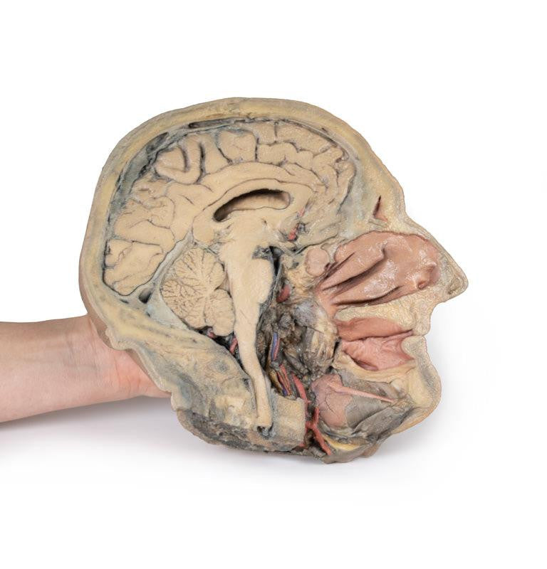 Median Section through head sagittal section of head with deep dissection 3D Replica MP1105 | Erler-Zimmer | Candent 3