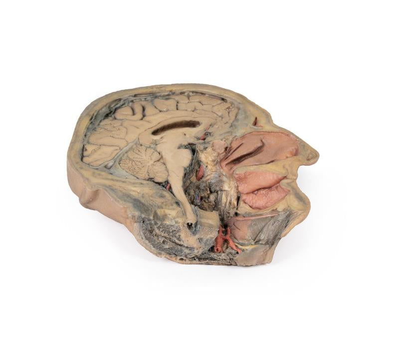 Median Section through head sagittal section of head with deep dissection 3D Replica MP1105 | Erler-Zimmer | Candent 4