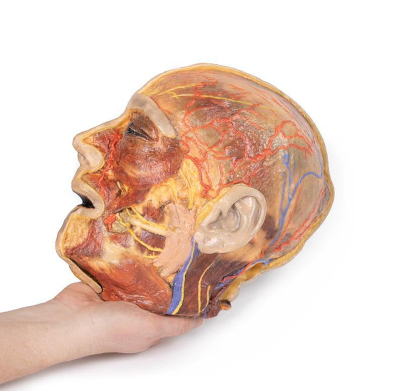 Superficial Facial nerves & Parotid Gland 3D Replica MP1109 | Erler-Zimmer | Candent