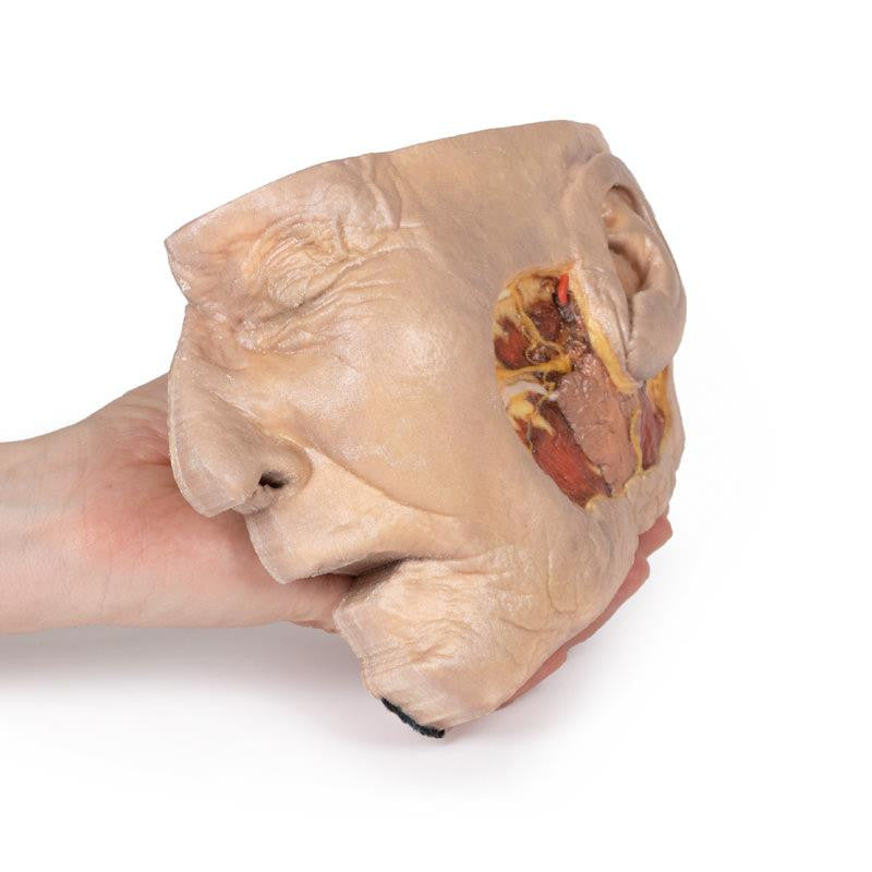 Parotid Gland and Facial Nerve dissection 3D Replica MP1112 | Erler-Zimmer | Candent 3