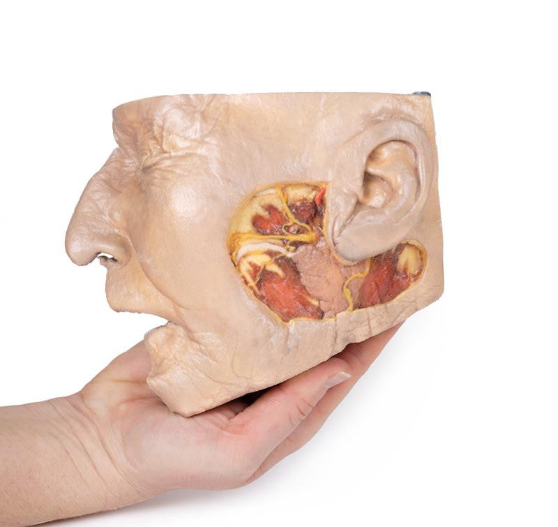 Parotid Gland and Facial Nerve dissection 3D Replica MP1112 | Erler-Zimmer | Candent 4