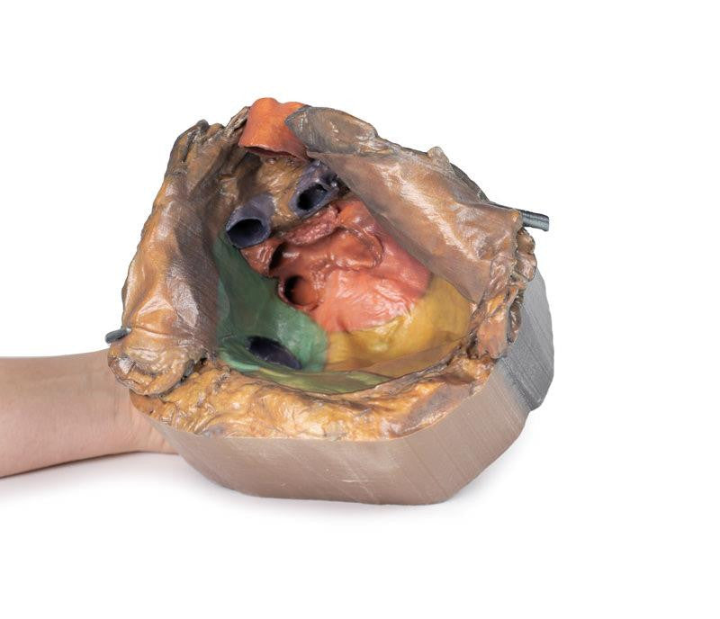 Pericardial space 3D Replica MP1121 | Erler-Zimmer | Candent