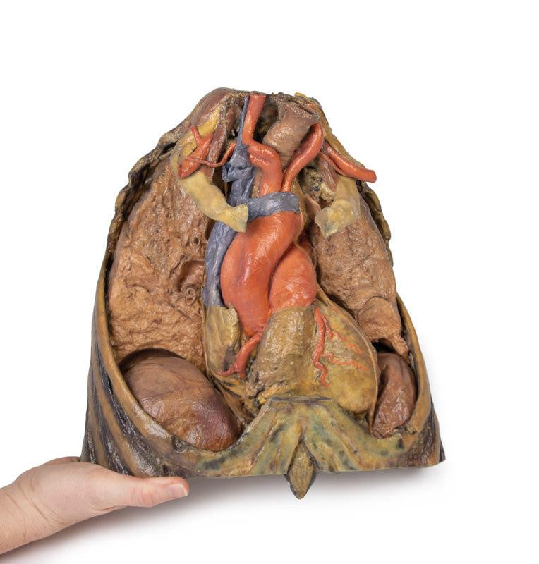 Thorax with heart and vessels 3D Replica MP1122 | Erler-Zimmer | Candent 3