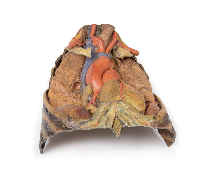 Thorax with heart and vessels 3D Replica MP1122 | Erler-Zimmer | Candent 2