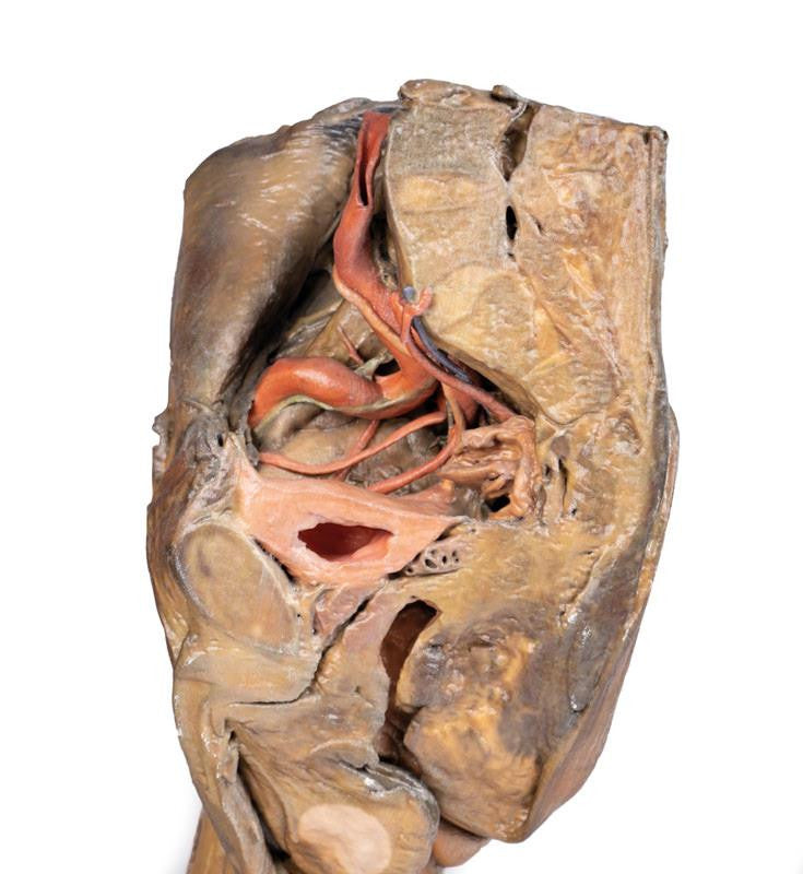 Hilum of the left lung 3D Replica MP1124 | Erler-Zimmer | Candent