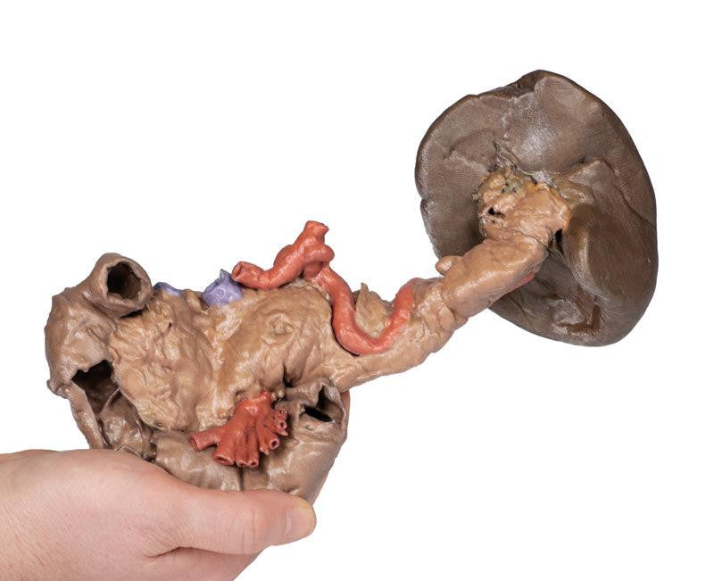 Spleen and pancreas 3D Replica MP1135 | Erler-Zimmer | Candent 3