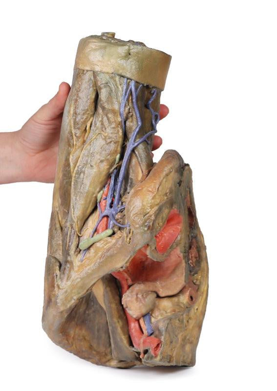 Female hemipelvis and thigh 3D Replica MP1140 | Erler-Zimmer | Candent 3