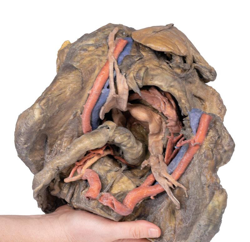 Female pelvis deep dissection 3D Replica MP1141 | Erler-Zimmer | Candent