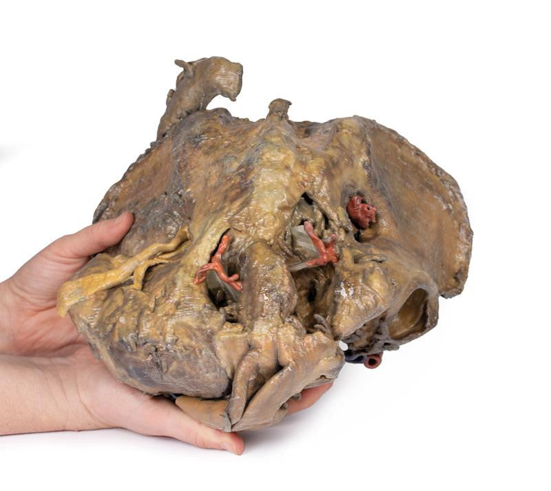 Female pelvis deep dissection 3D Replica MP1141 | Erler-Zimmer | Candent 4