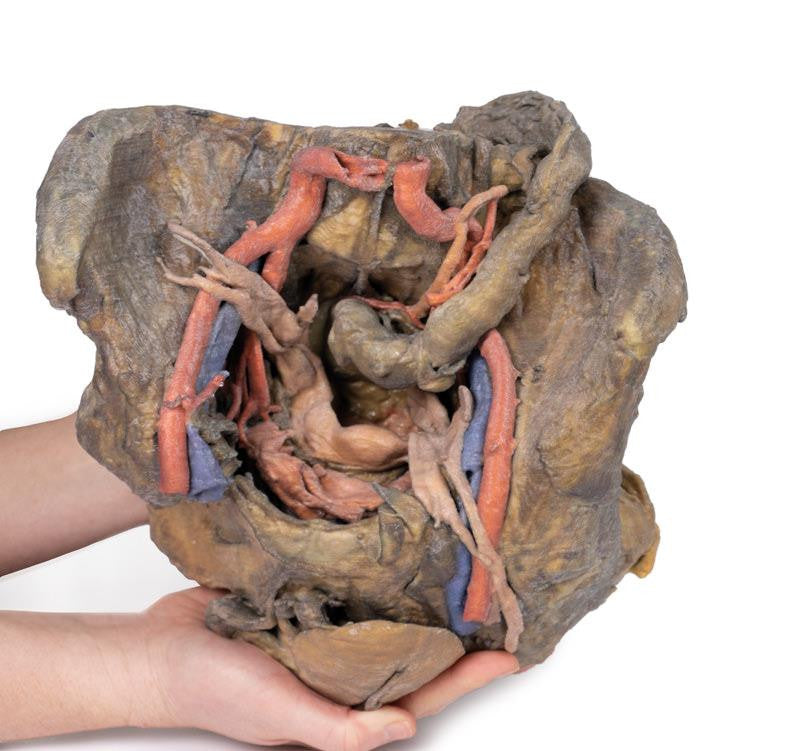 Female pelvis deep dissection 3D Replica MP1141 | Erler-Zimmer | Candent 3