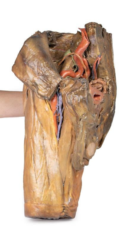 Male hemipelvis and thigh 3D Replica MP1142 | Erler-Zimmer | Candent 4