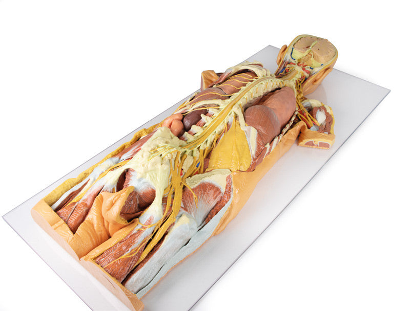 Nervous System Dissection (posterior view) - 3D Printed Cadaver