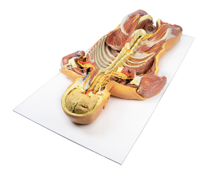Posterior Body Wall / Ventral Deep Dissection - 3D Printed Cadaver