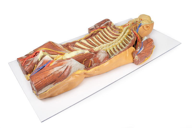 Posterior Body Wall / Ventral Deep Dissection - 3D Printed Cadaver