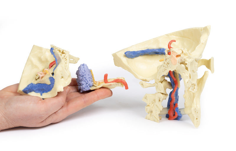 Temporal Bone Model, Set of 3 - 3D Printed Cadaver