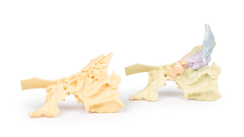Paranasal Sinus model - 3D Printed Cadaver