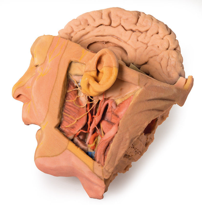Head and Neck Replica - 3D Printed Cadaver