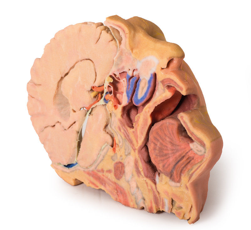Head and Neck Replica - 3D Printed Cadaver
