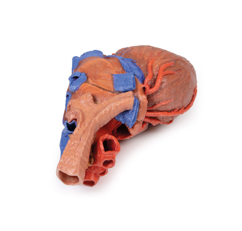 Heart and the distal trachea, carina and primary bronchi - 3D Printed Cadaver
