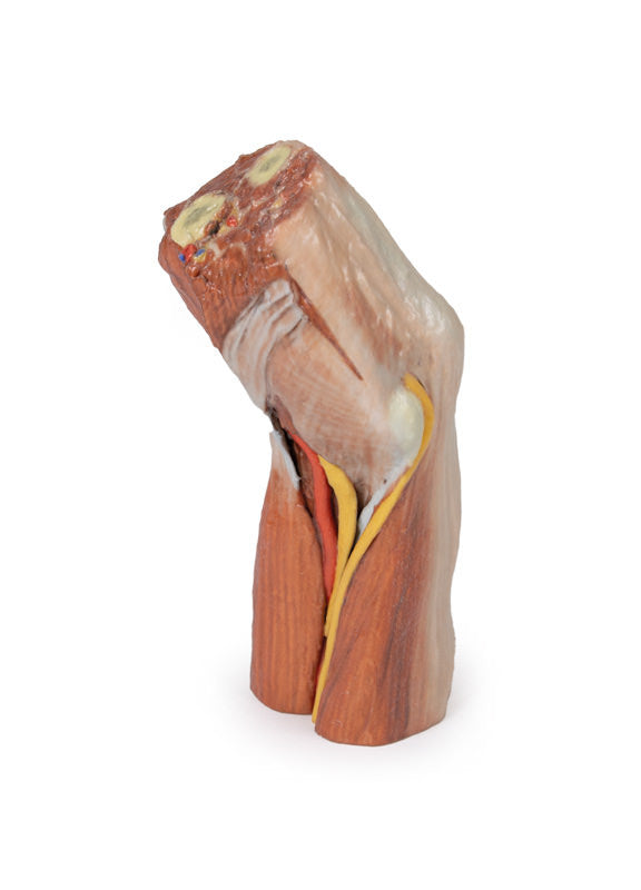 Cubital fossa - muscles, large nerves and the brachial artery - 3D Printed Cadaver