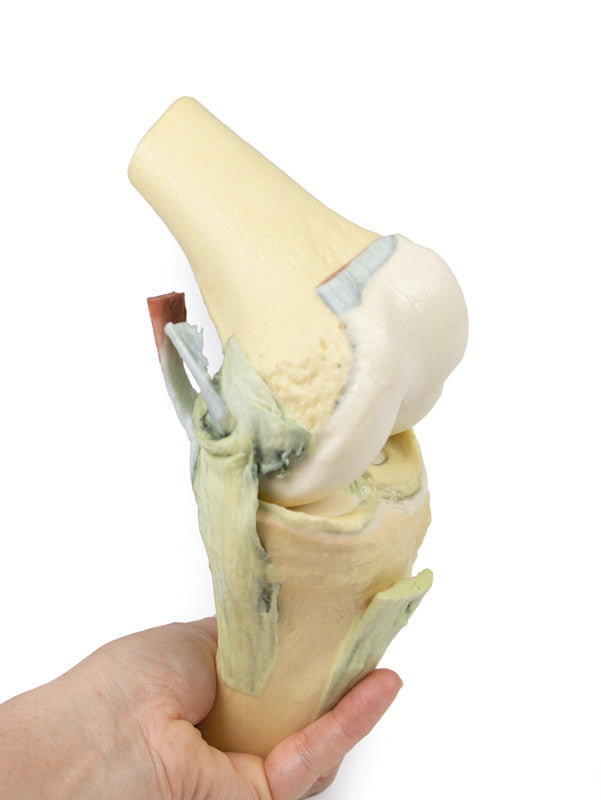 Knee Joint - 3D Printed Cadaver