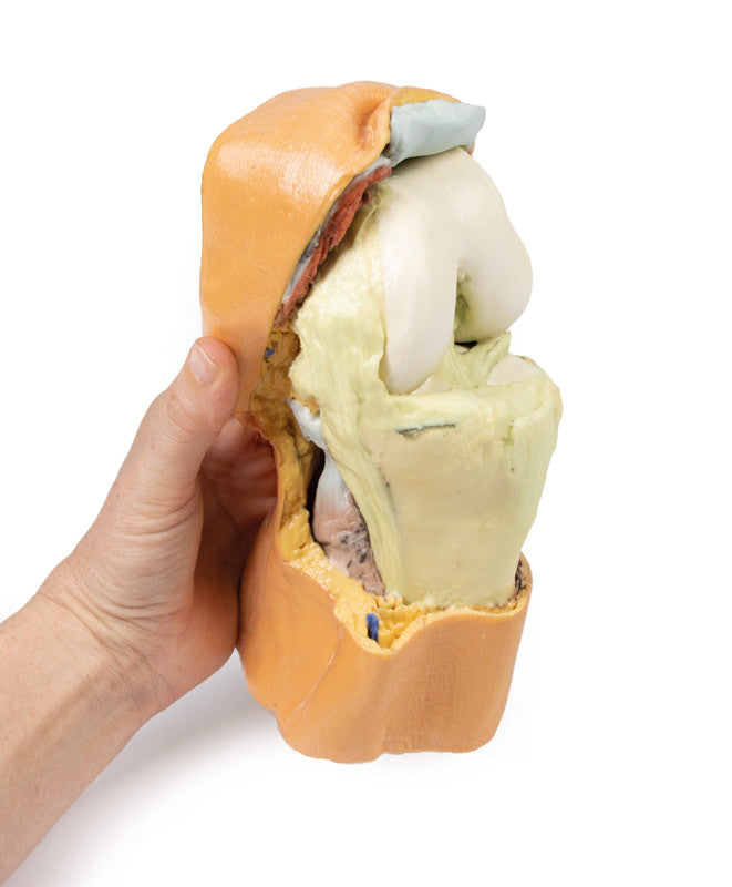 Flexed knee joint deep dissection - 3D Printed Cadaver