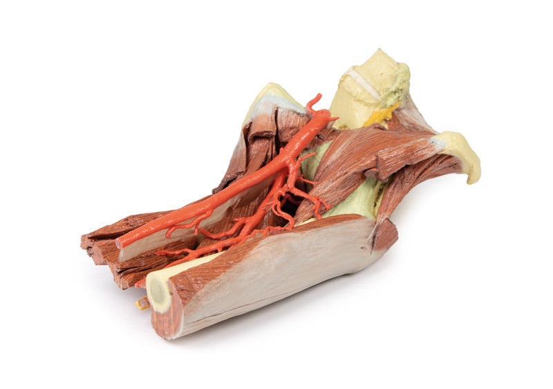 Lower Limb - deep dissection of a left pelvis and thigh - 3D Printed Cadaver