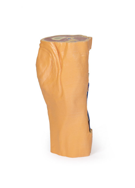 Popliteal Fossa distal thigh and proximal leg - 3D Printed Cadaver
